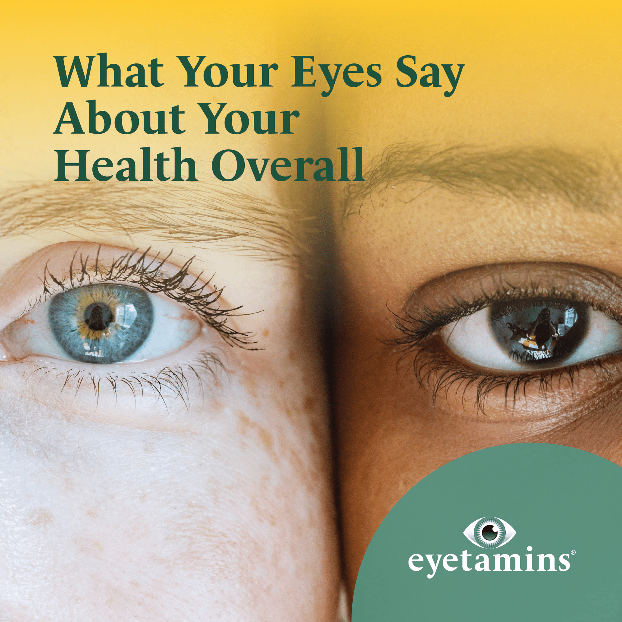 Eyetamins - What Your Eyes Say About Your Health Overall
